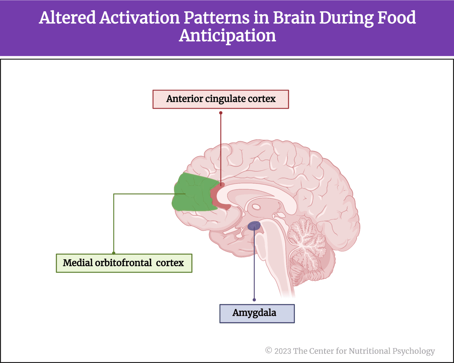 Patterns Of Neural Activity In Obese Persons - The Center for ...