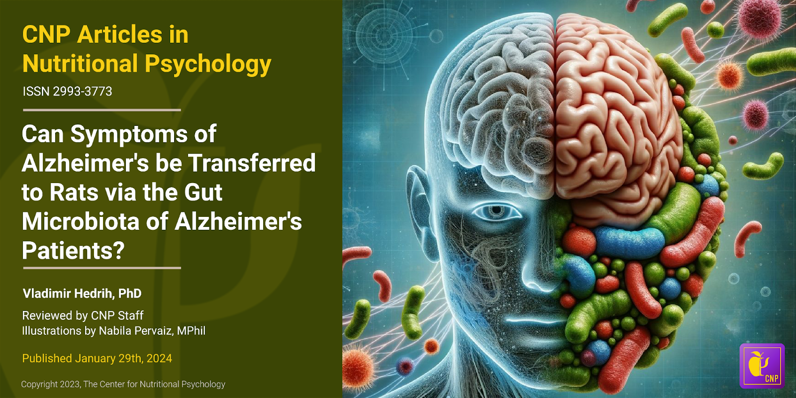 Can Symptoms of Alzheimer's be Transferred to Rats via the Gut Microbiota of Alzheimer's Patients